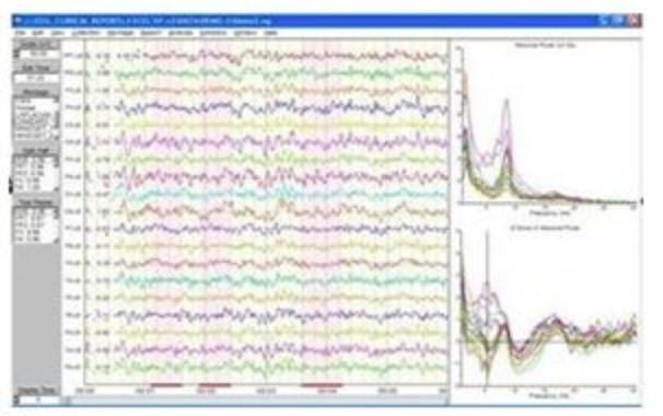 Module de collection NeuroGuide