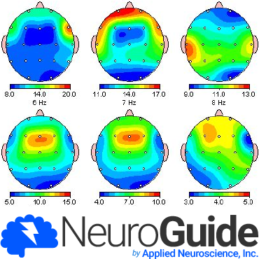 Logiciel Neuroguide