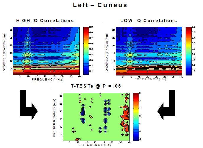 Logiciel Neuroguide